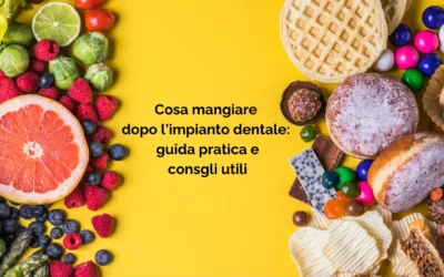 Cosa mangiare dopo un impianto dentale: guida pratica e consigli utili
