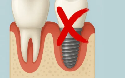 Impianti Dentali Controindicazioni: quando evitare questa soluzione?