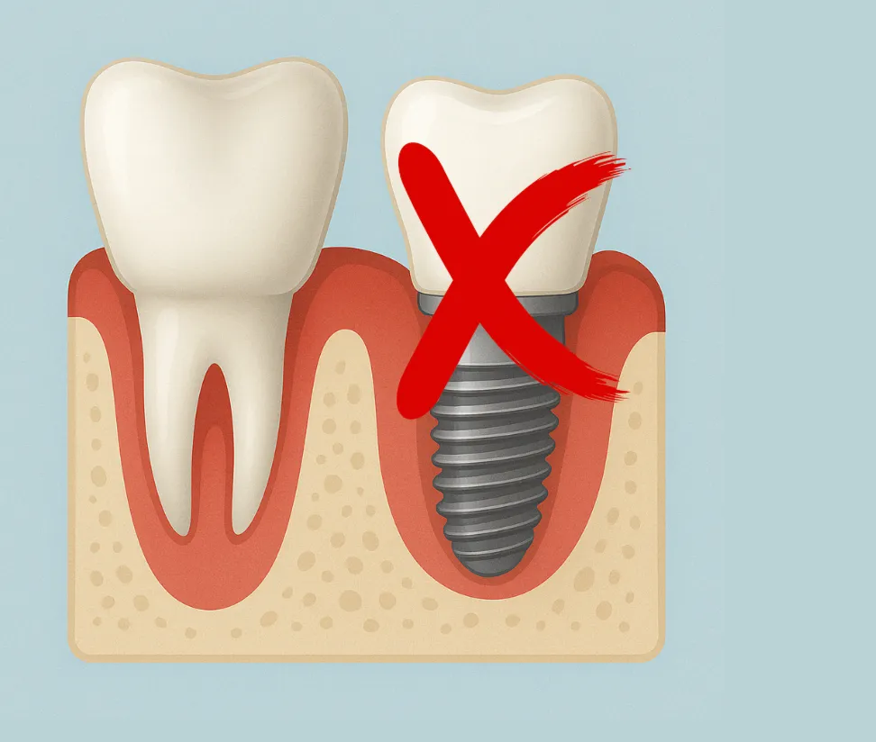 Impianti Dentali Controindicazioni – quando evitare questa soluzione_11zon